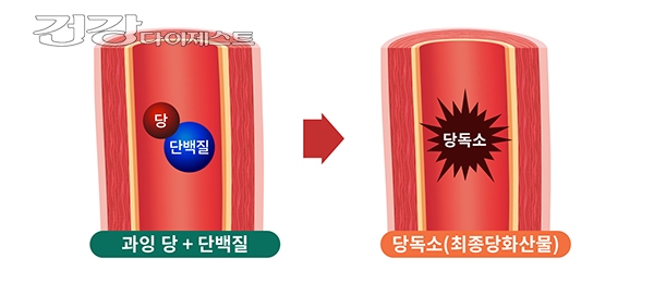 [대국민 건강 캠페인] 건강의 ‘적’ 당독소가 뭐기에?